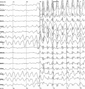 Video Games' Effects on EEG Data
