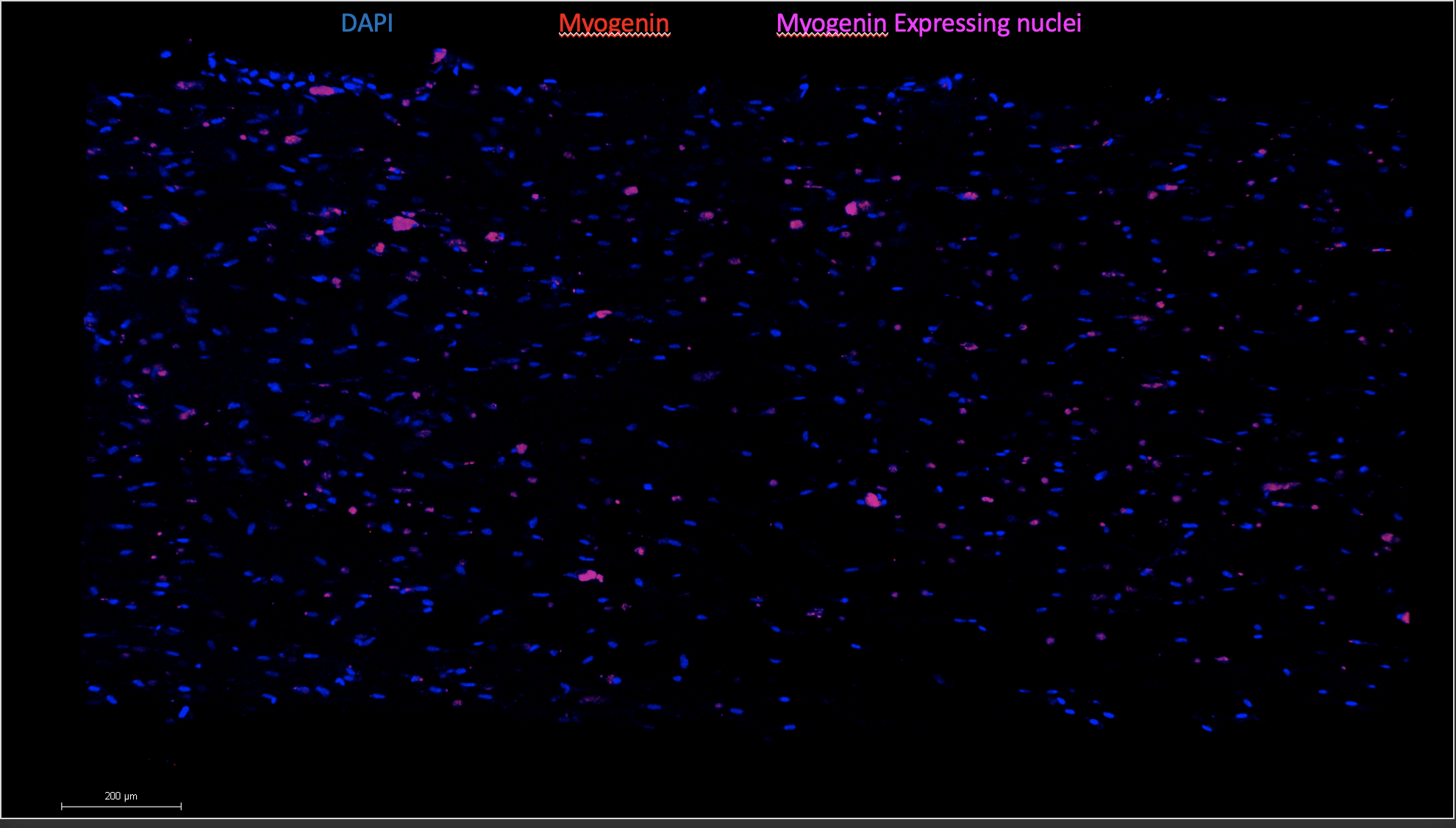 Detecting Nuclei with Python